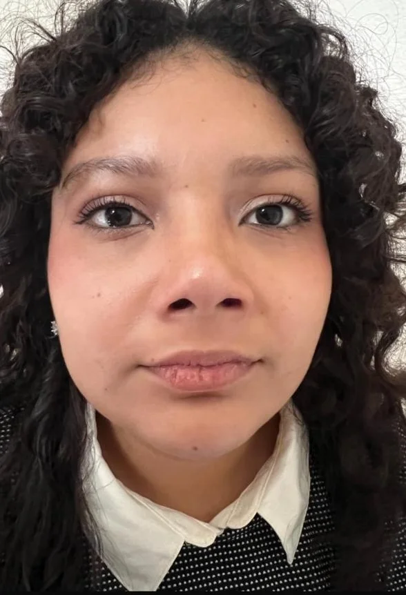 Rinoplastia